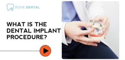 What Is the Dental Implant Procedure?