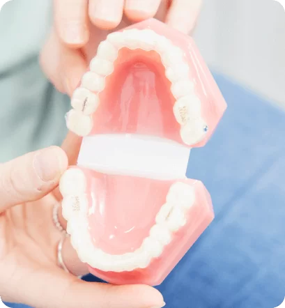 Invisalign At Dove Dental Waurn Ponds