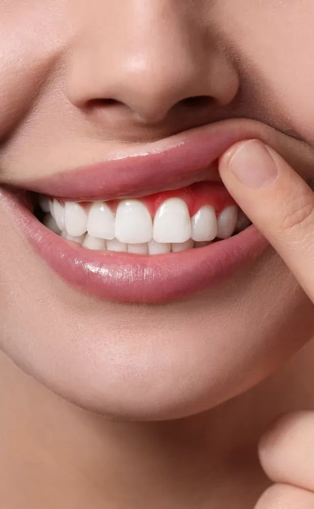 Understanding Periodontitis In Waurn Ponds, Geelong At Dove Dental