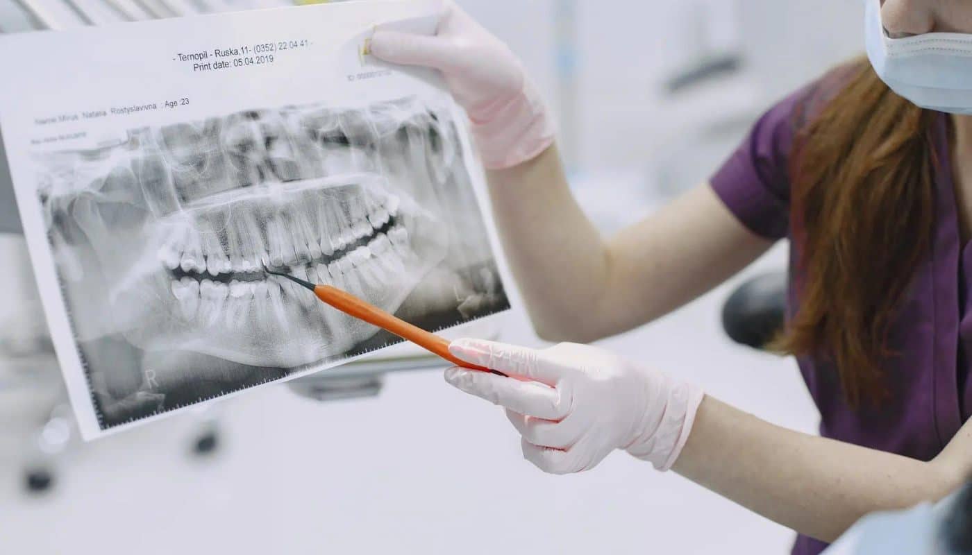 A gloved clinician pointing out detail on a printed panoramic dental x-ray