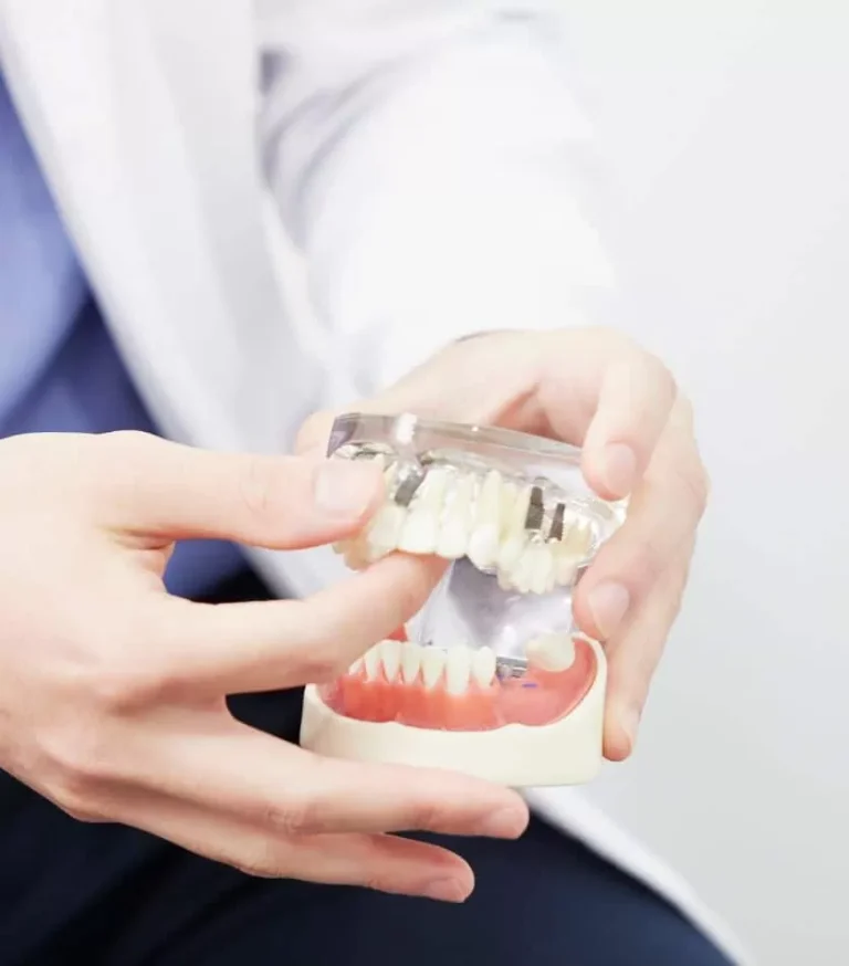 A dentist holding a cutaway jaw model showing how dental implants sit in the bone