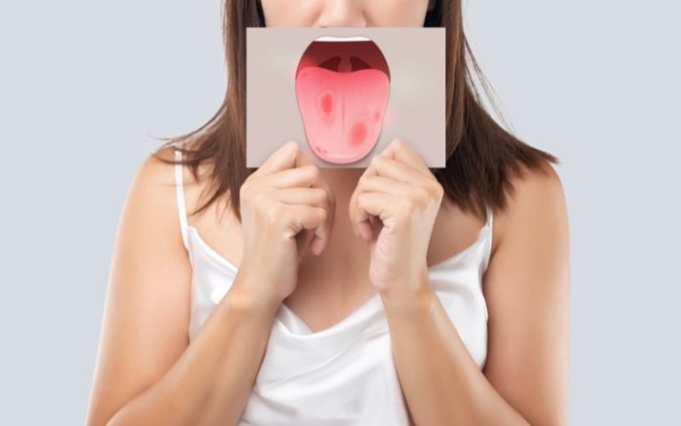 A woman holding up a card showing an illustration of an open mouth in front of her face