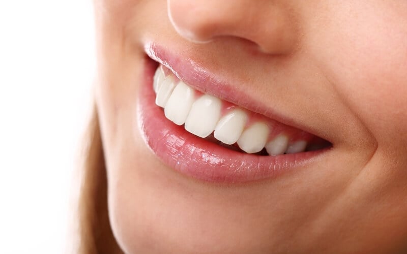 Close-up of a woman’s smile showing healthy white teeth