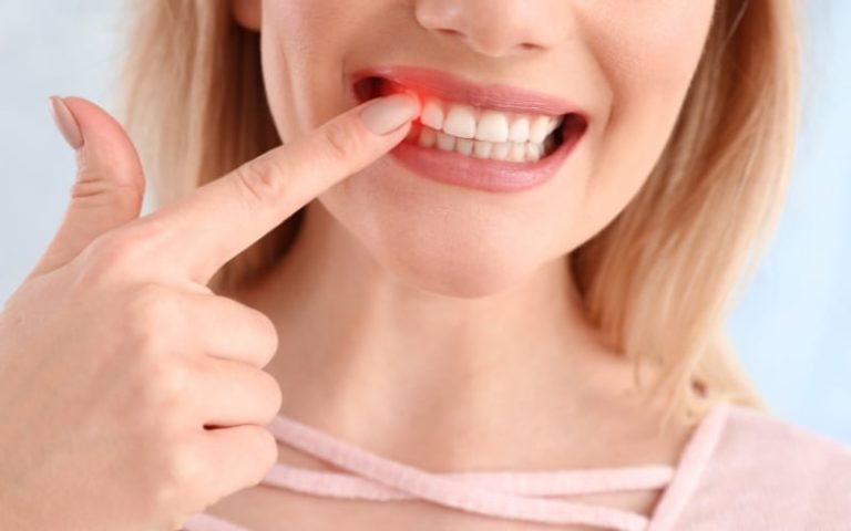 A woman pointing to a red, inflamed area of her gum