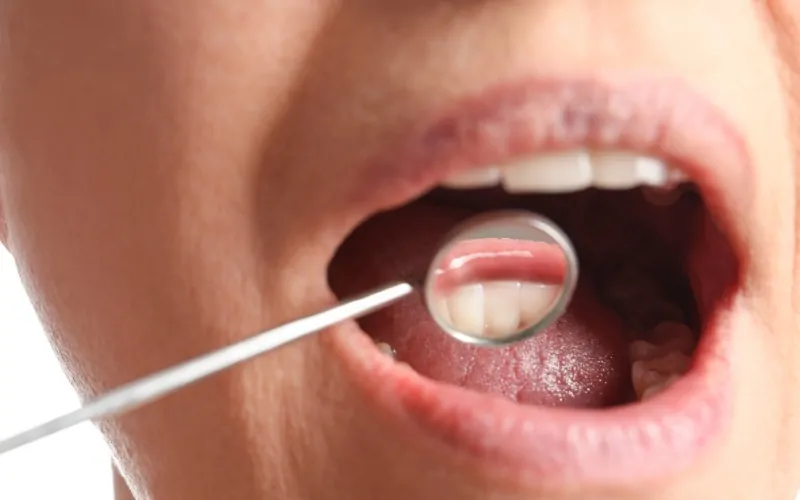 Close-up of an open mouth with a dental mirror reflecting the lower teeth