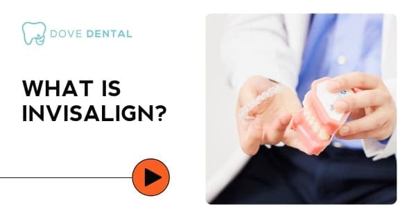 Video thumbnail titled “What Is Invisalign?”