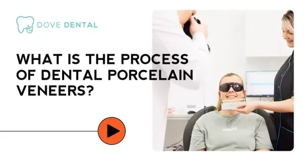 Video thumbnail titled “What Is the Process of Dental Porcelain Veneers?”