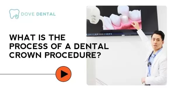 Video thumbnail titled “What Is the Process of a Dental Crown Procedure?”