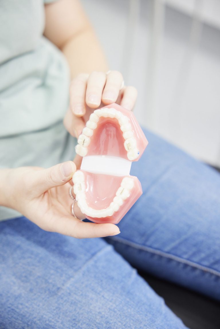 A patient holding a full upper and lower denture model in her hands